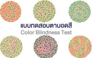 Color blindness